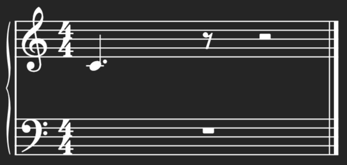Showing a dotted quarter note and its relationship to the time signature.